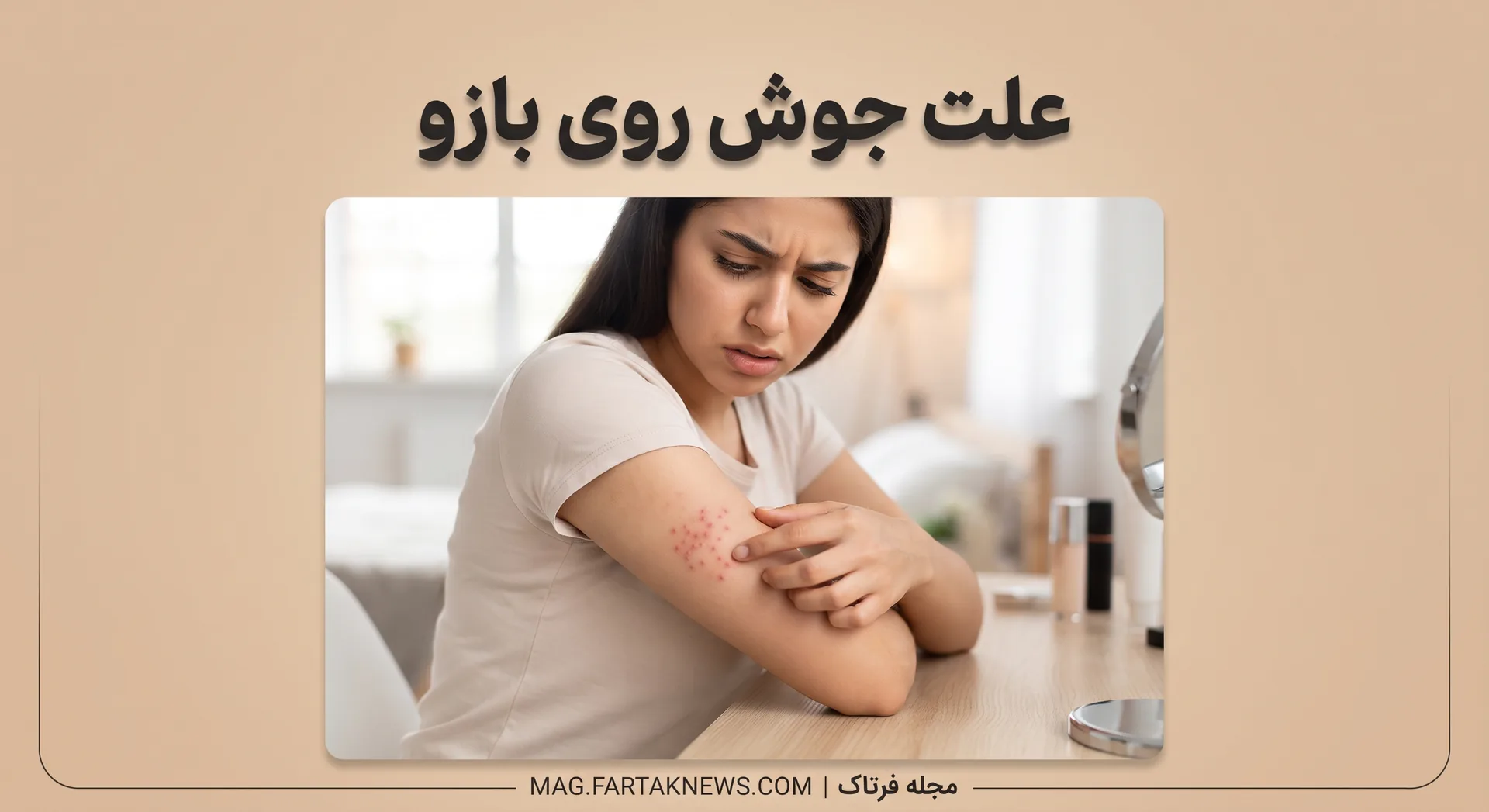 علت جوش روی بازو