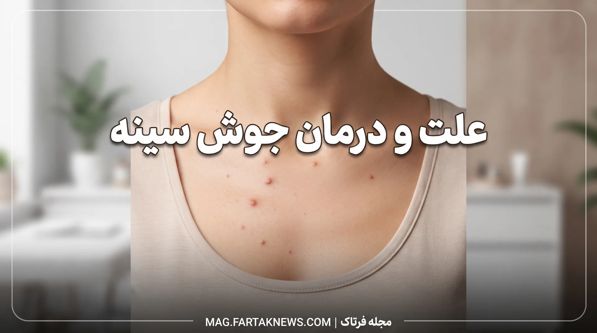 علت و درمان جوش سینه