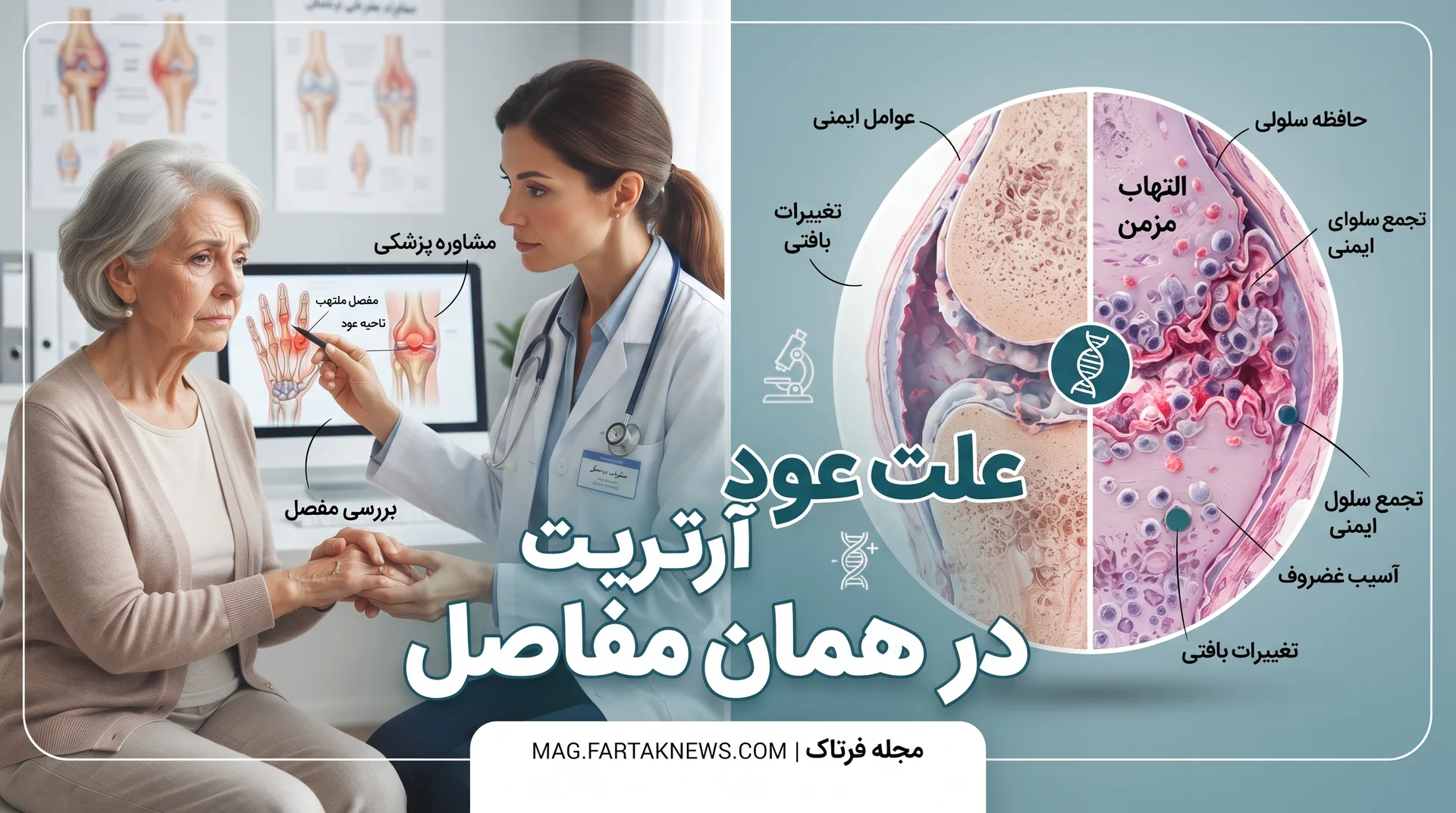 چرا آرتریت دقیقاً در همان مفاصل قبلی عود می‌کند؟